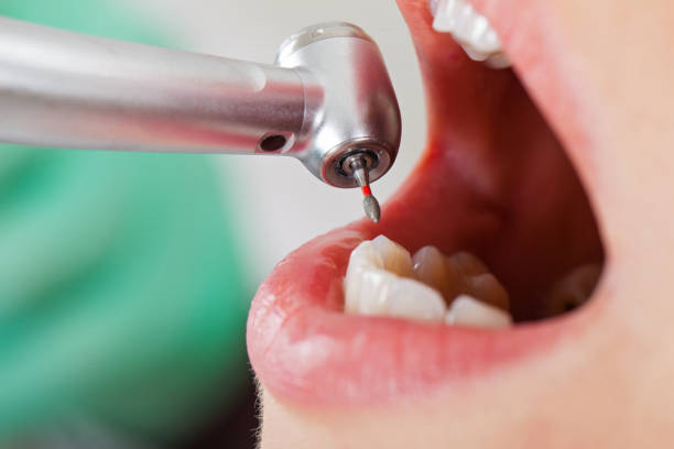 Best Emergency Treatment for Oral Infections in Calabash, NC